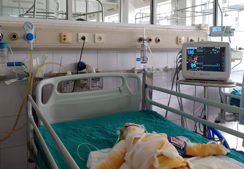 Một trong 3 ch&aacute;u b&eacute; đang được điều trị tại Khoa Hồi sức t&iacute;ch cực, Viện Bỏng Quốc gia.