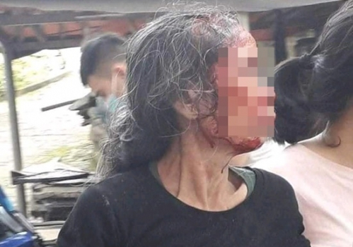 Phú Thọ: Con rể chém mẹ vợ cũ trọng thương