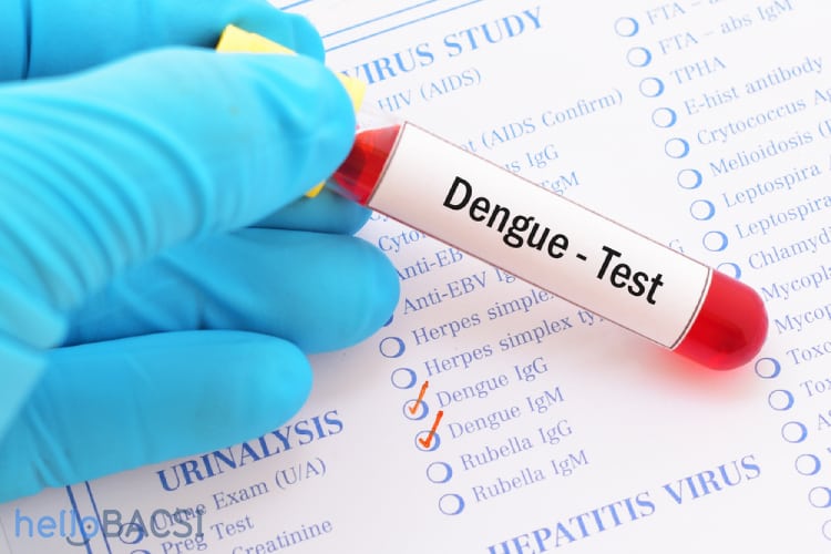 Thử m&aacute;u gi&uacute;p chẩn đo&aacute;n v&agrave; theo d&otilde;i điều trị bệnh sốt xuất huyết