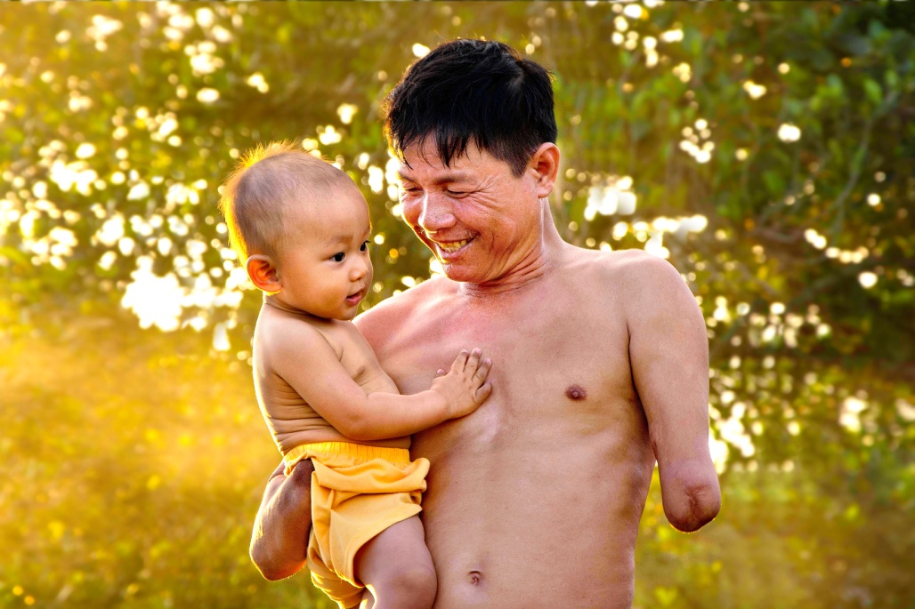 T&igrave;nh y&ecirc;u chan chứa của người cha tật nguyền d&agrave;nh cho đứa con thơ qua nụ cười &ndash; &aacute;nh mắt tr&igrave;u mến