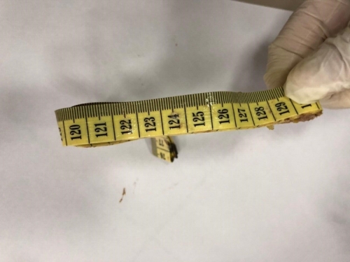 Say rượu, thiếu nữ ở Lạng Sơn nuốt trọn thước dây vào bụng