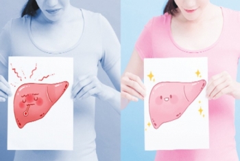 Cách nhận biết bệnh gan qua sự thay đổi sắc tố của làn da