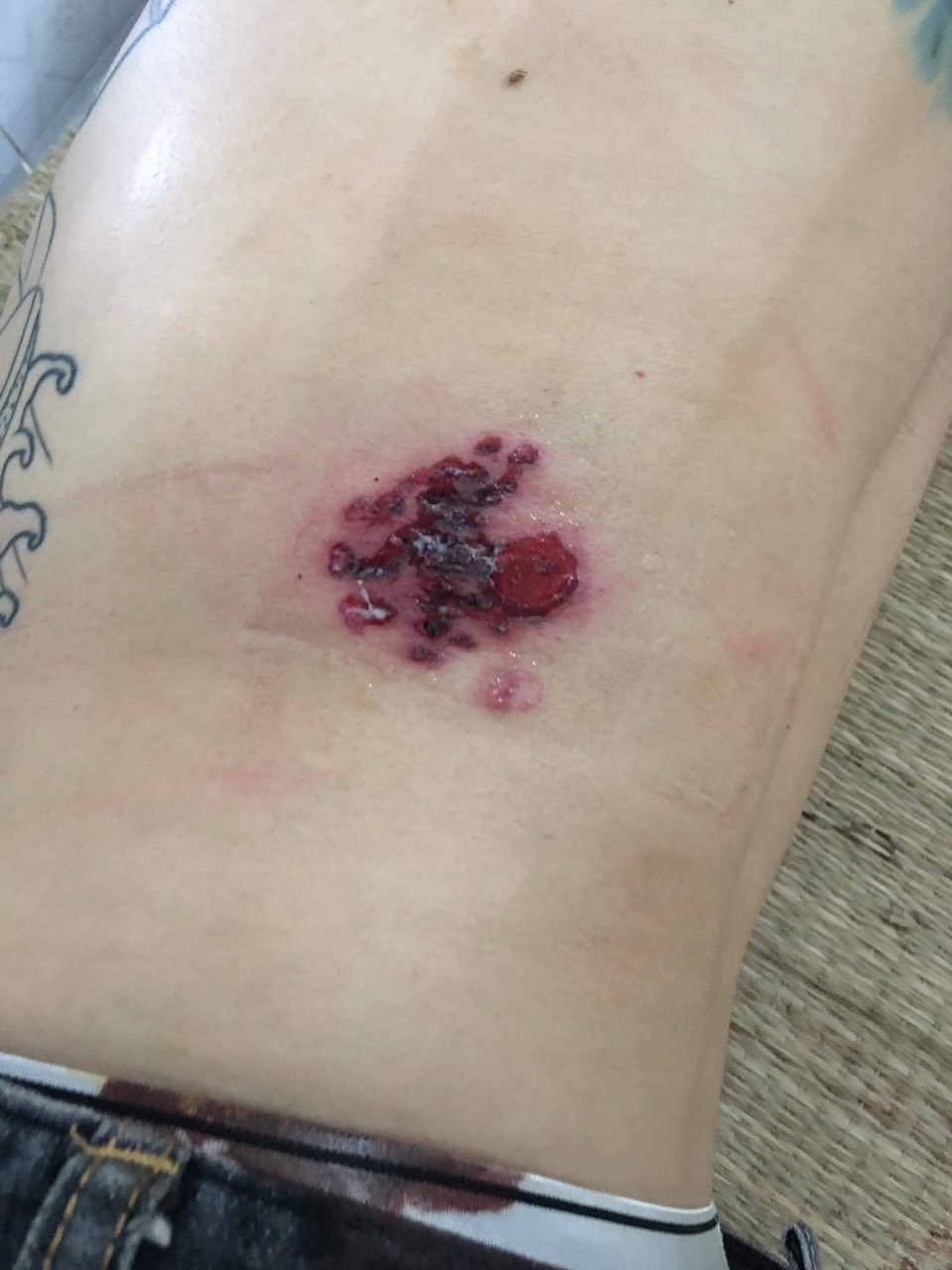 Mâu thuẫn vì không chào, dùng súng ....bắn nhầm vào bạn mình