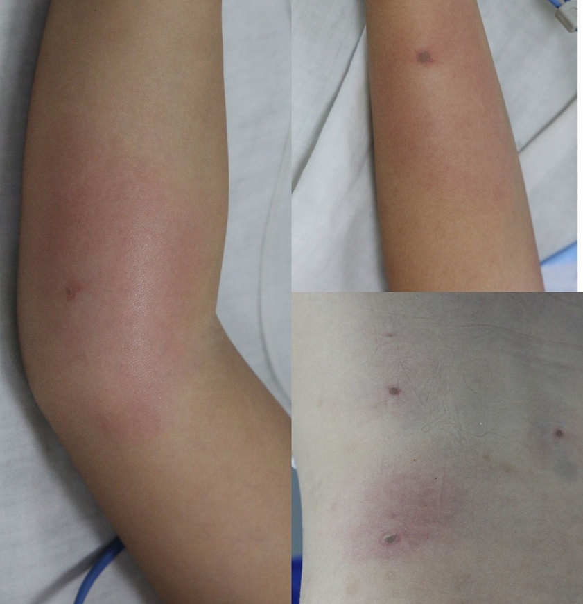 Phú Thọ: Cấp cứu nhiều trẻ bị ong đốt nguy kịch