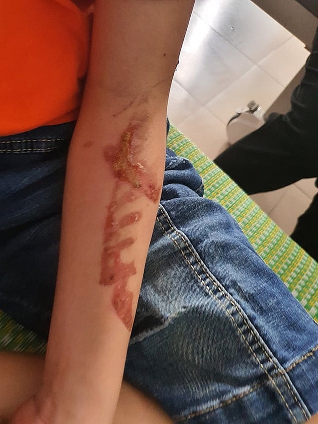 Nữ chủ quán bánh xèo bị tố tra tấn nhân viên khai gì?