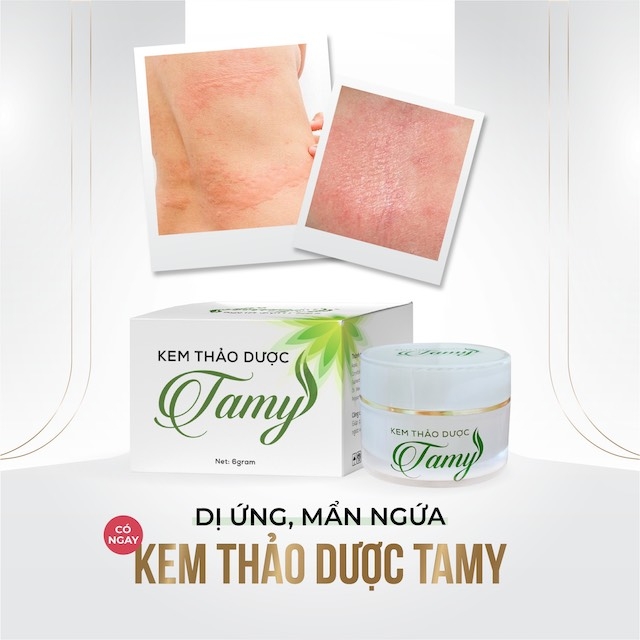 Nếu không chăm sóc và bảo vệ cẩn thận, làn da sẽ là đối tượng cho những căn bệnh ngoài da tấn công và gây hại