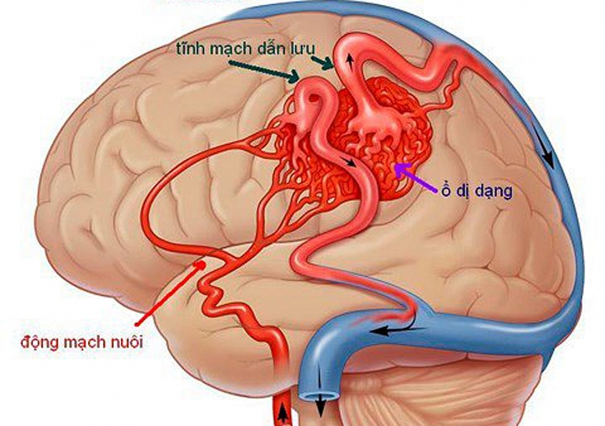 Vấn đề của hệ tim mạch