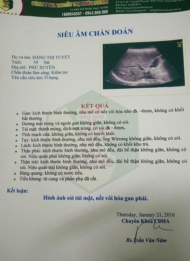 Những người phụ nữ chiến thắng ung thư buồng trứng