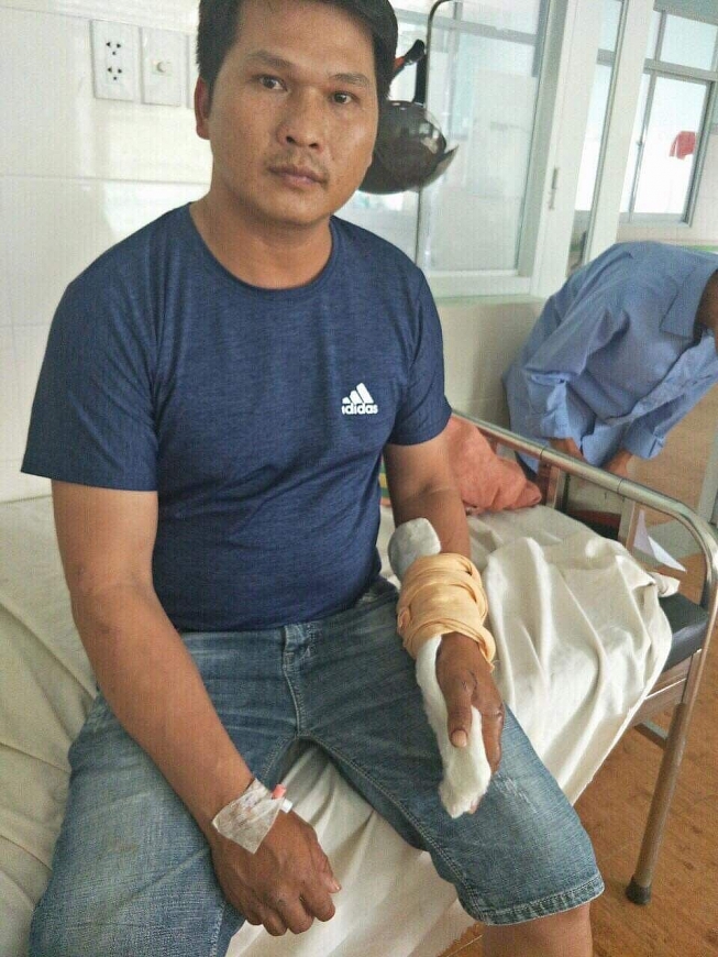 Ai chủ mưu trong vụ án cố ý gây thương tích ở huyện Bảo Lâm?