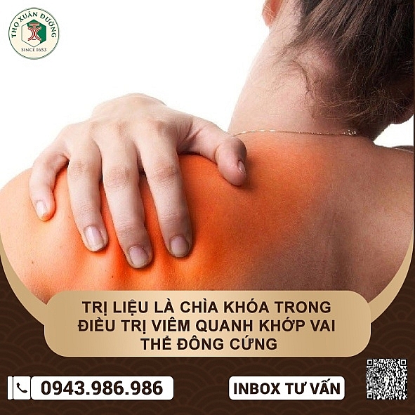 Trị liệu điều trị viêm quanh khớp vai thể đông cứng hiệu quả