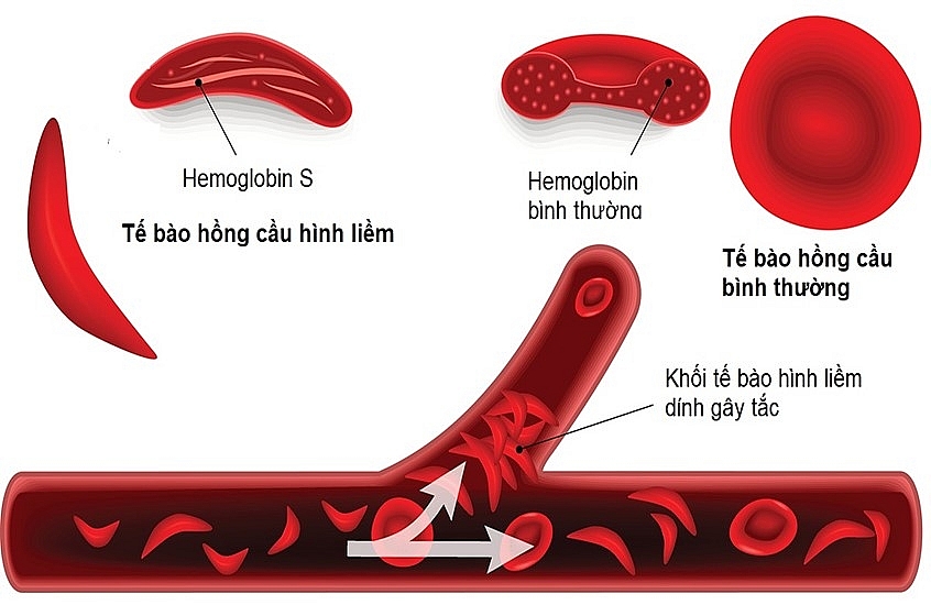 Vấn đề của hệ tim mạch Vấn đề của hệ tim mạch