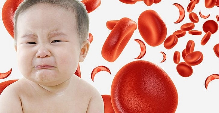 Vấn đề của hệ tim mạch