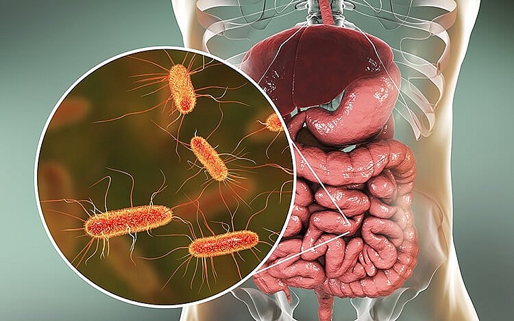 Vi khuẩn E.Coli không “lành” và cách phòng ngộ độc thực phẩm