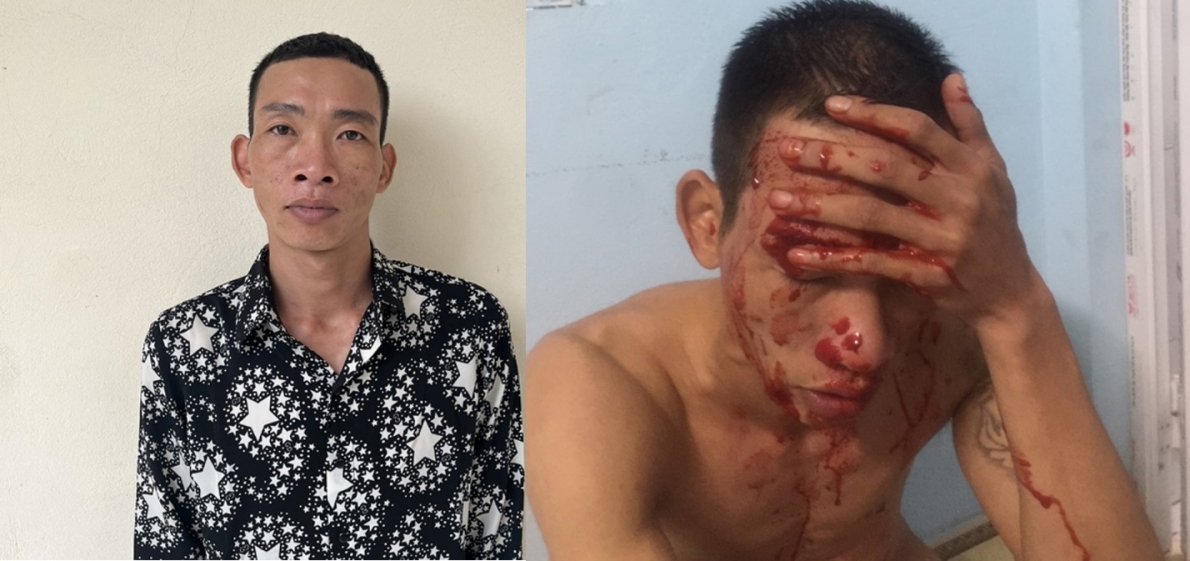 Tổng hợp  pháp luật  (27/4): 3 thanh niên tông chết kẻ trộm chó; bôi tiết lợn tống tiền bố ruột