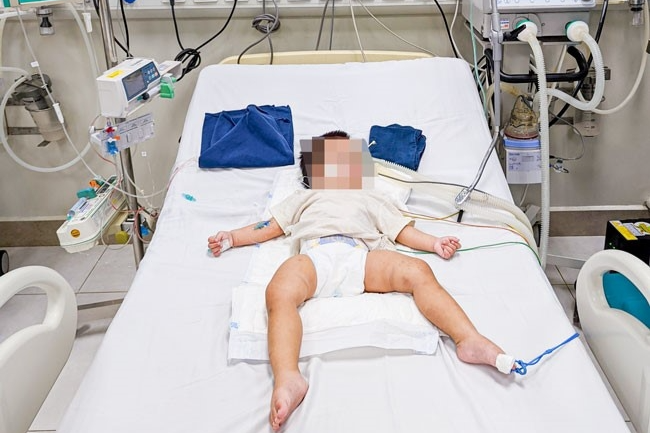Bé gái 18 tháng tuổi nhập viện trên người nhiều vết bầm tím nghi bị bạo hành