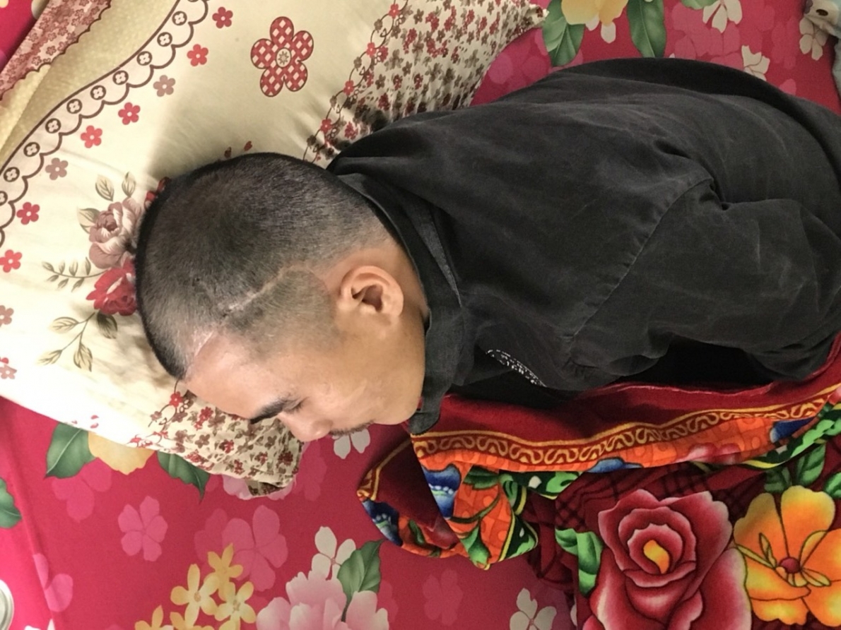 Cơ quan chức năng chậm giải quyết vụ án con trai bị chém vỡ sọ, người cao tuổi kêu cứu Cơ quan chức năng chậm giải quyết vụ án con trai bị chém vỡ sọ, người cao tuổi kêu cứu