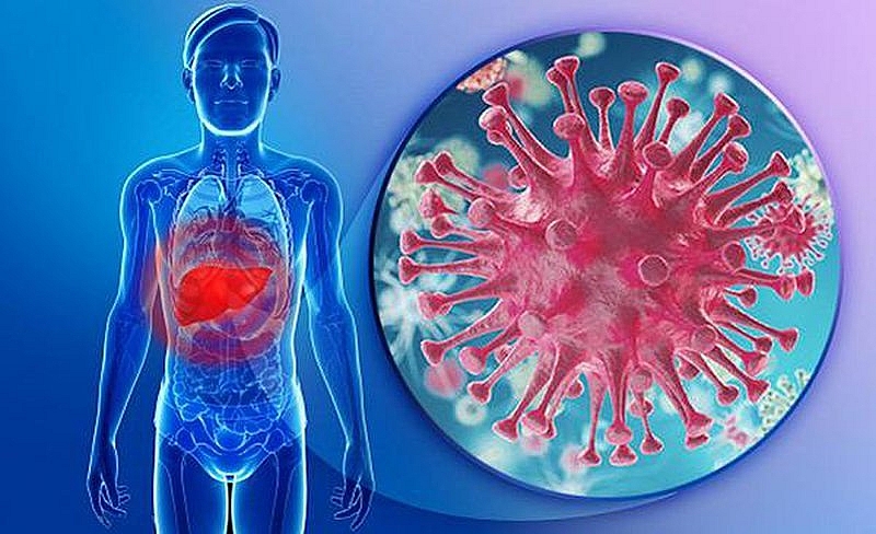 Nhiễm virus viêm gan B không triệu chứng mối lo của nhiều người