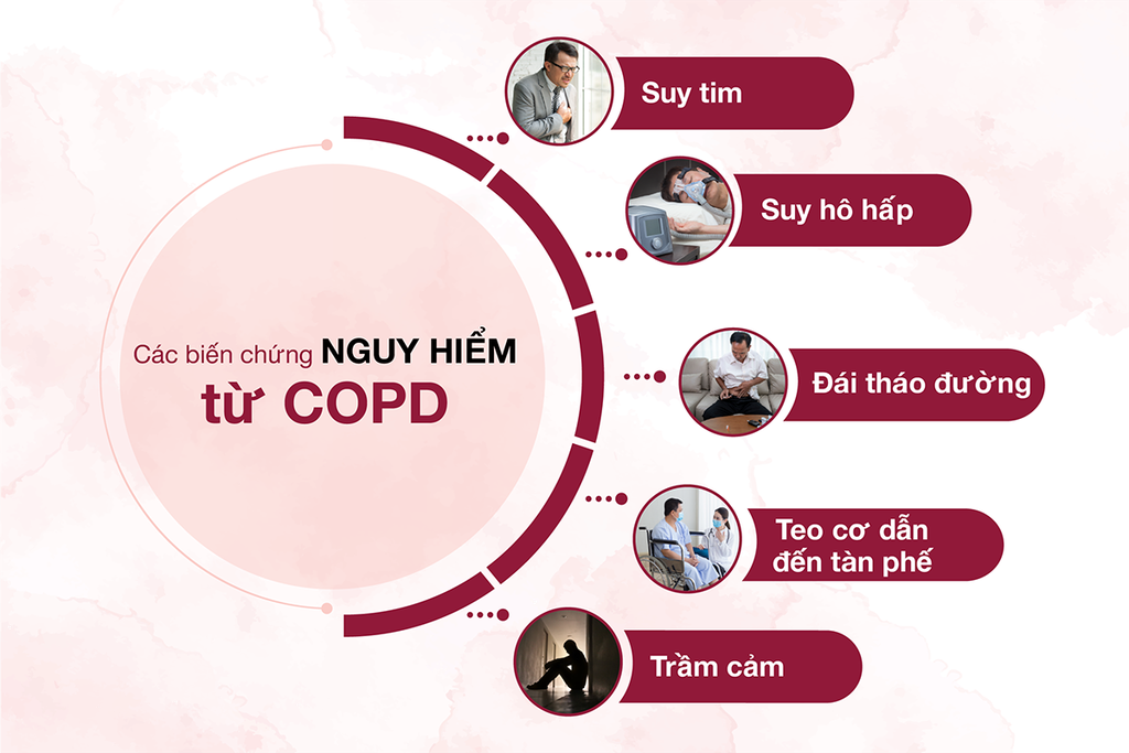 Phòng ngừa nguy cơ cho người bệnh phổi tắc nghẽn mạn tính