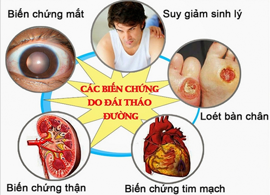 Các biến chứng do đái tháo đường