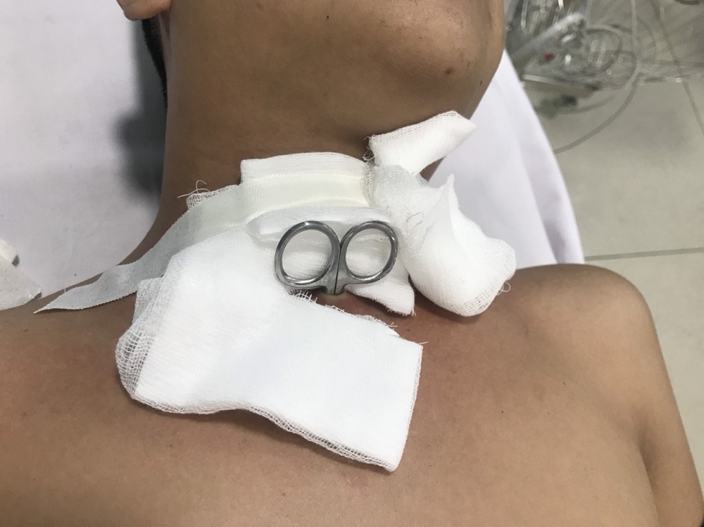 Nam thanh niên tự đâm kéo vào cổ